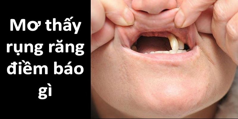 Nằm Mơ Rụng Răng Là Gì Và Những Con Số Lô Đề May Mắn
